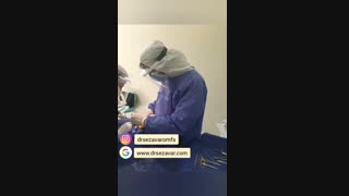 عمل آگمنتاسیون صورت