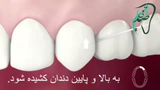 فیلم نحوه استفاده از نخ دندان