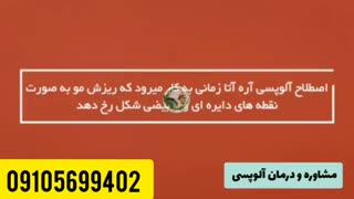 آلوپسی داری نمیدونی چکار کنی جرمگیری