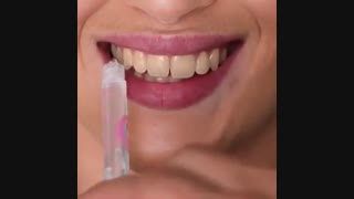 بلیچینگ دندان