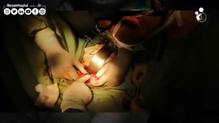 واژینو پلاستی سیگموید