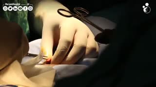 همه چیز درباره ختنه