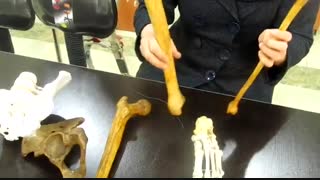 عملی استخوان فیبولا و تارسوس و...