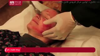 از بین بردن لکه های پوستی با درمارولر ( پاکسازی پوست ) ابرسانی پوست