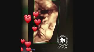 سونوگرافی از یه جنین جذاب