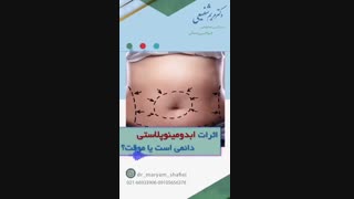 اثرات ابدومینوپلاستی دائمی است یا موقت؟