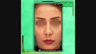 جراحی زیبایی بینی | فوق تخصص جراحی پلاستیک | دکتر عبدالرضا روئین تن