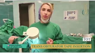 فیلم جراحی بی اختیاری ادرار شدید (جراحی TOT)