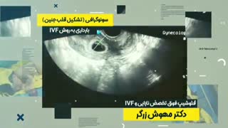 صدای قلب جنین