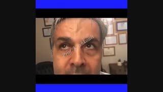 اصلاح بیرون زدگی چشم توسط پروفسور کشکولی | فوق تخصص جراحی پلاستیک چشم