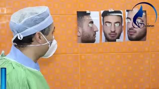 جراحی زیبایی بینی