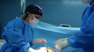 فیلم زایمان سزارین