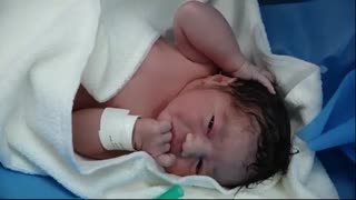 فیلم عمل زایمان سزارین