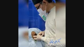 فیلم جراحی زیبایی گوش
