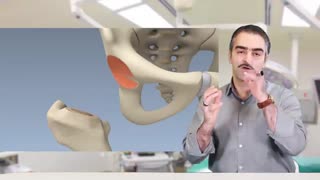 تعویض مفصل لگن