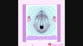 انیمیشنی از چگونگی لابیاپلاستی