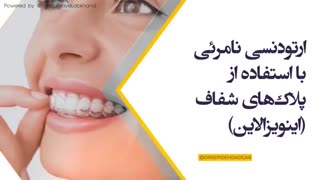 انواع ارتودنسی نامرئی | دکتر سپیده دادگر