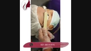 فیلم واقعی پاک کردن تاتو با لیزر