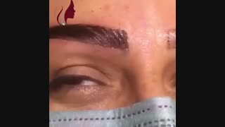 فیلم رضایتمندی مراجعه کننده عزیز حین کاشت ابرو