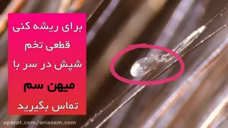آیا راهی برای خلاصی از شپش ها وجود دارد؟ | شامپو ضد شپش خارجی