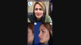 رضایت بیمار سه ماه بعد از جراحی زیبایی بینی | متخصص گوش و حلق و بینی | دکتر محمد گلی
