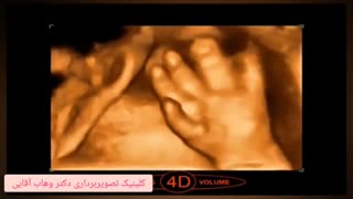 تفاوت سونوگرافی های دو بعدی، سه بعدی و چهاربعدی چیست؟