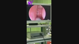 جراحی لوزه در کودک 9 ساله