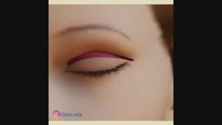 جراحی زیبایی پلک