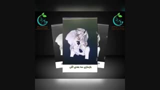 درمان شکستگی پیچیده لگن