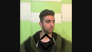 قبل و بعد از جراحی بینی توسط دکتر محمود ناظمیان