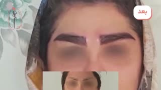 نمونه قبل و بعد کاشت ابرو روی تاتوی قبلی و قرینه سازی ابروها