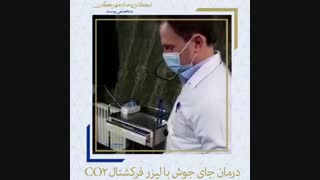 درمان جای جوش با لیزر فرکشنال CO2 لیپوساکشن