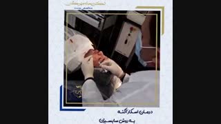 درمان اسکار آکنه (جای جوش) درمان سلولیت