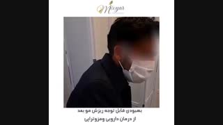 بهبودی قابل توجه ریزش مو بعد از درمان دارویی و مزوتراپی