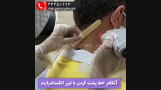 آنکادر خط پشت گردن با لیزر