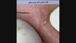چندش های دوست داشتنی