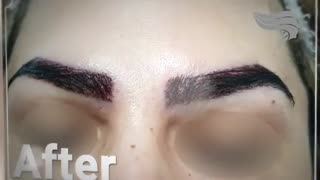 کاشت برای ابرو با تراکم کم