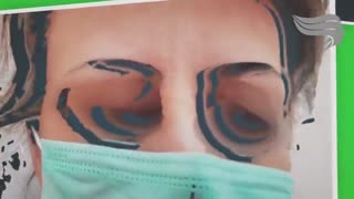 کاشت ابرو پرطرفدار