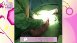 فیلم واقعی زایمان در اتاق عمل