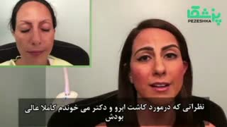 کاشت ابرو چه تاثیری بر چهره دارد؟