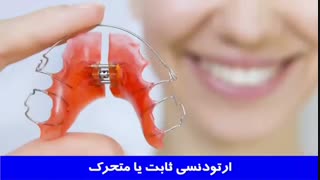 ارتودنسی ثابت و ارتودنسی متحرک چه تفاوت هایی دارند؟ | دکتر احسان مهریزی