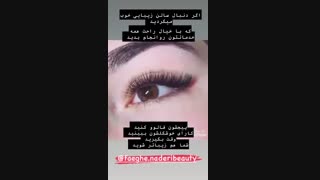 زیبایی پوست و مو @faeghe.naderibeauty جراحی بینی