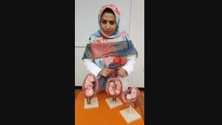 وضعیت مختلف قرار گیری جنین در رحم مادر