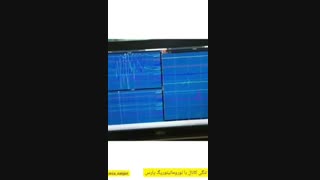 درمان تنگی کانال با نورومانیتوریگ پارس