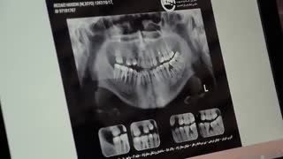 طرح درمان تخصصی ارتودنسی | دکتر داودیان