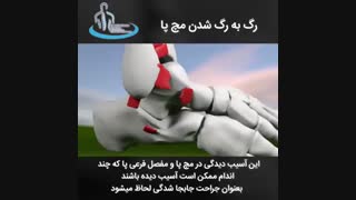 رگ به رگ شدن مچ پا | متخصص ارتوپد | دکتر محمدابراهیم طاهریان