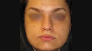 فیلم عمل بینی گوشتی زنانه