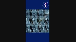 آرتروسکوپی زانو و کاربردهای آن چیست؟