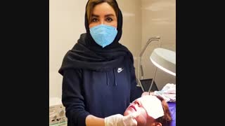 مزوتراپی لیزر فرکشنال