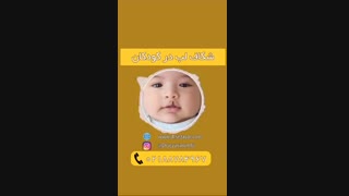 شکاف کام - لب شکری